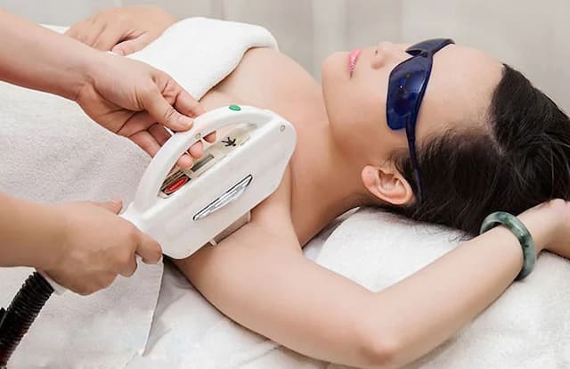 Mẹo triệt lông nách bằng laser