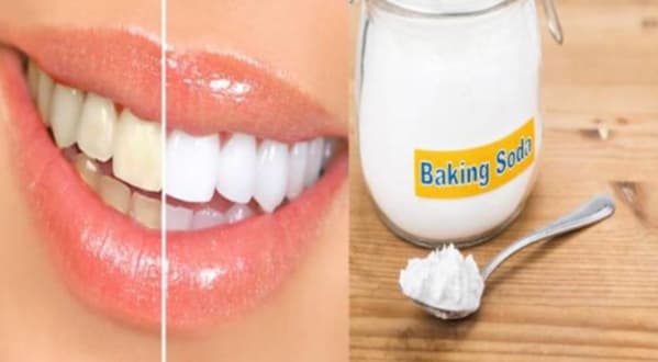 Dùng Baking Soda để tẩy trắng răng